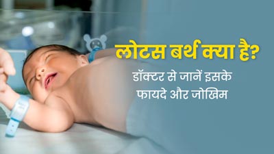 लोटस बर्थ क्या है? डॉक्टर से जानें इसके फायदों और खतरों के बारे में