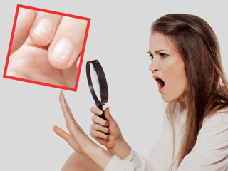 नाखून पर सफेद निशान क्यों होते हैं? जानें इसके कारण और बचाव का तरीका