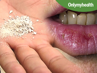 मुंह के कैंसर को बढ़ाता है तंबाकू का अधिक सेवन, जानें लक्षण और बचाव