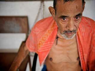 टीबी से हर तीन मिनट में दो की मौत: लोगों में इसके प्रति जागरूकता जरूरी