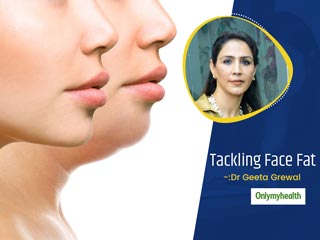 Face Fat & Social Media: How Face Fat Can Be Tackled, Invasively & Non-Invasively